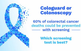 colonoscopy or cologuard is best for colon cancer screening