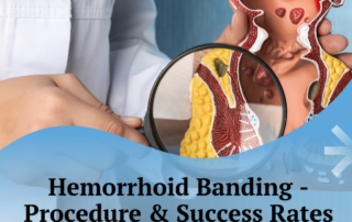 Hemorrhoid Banding - Procedure & Success Rates