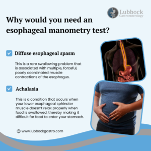 Why would you need an esophageal manometry test