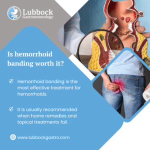 Is hemorrhoid banding worth it?