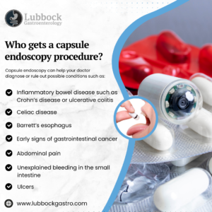 Who gets a capsule endoscopy procedure 